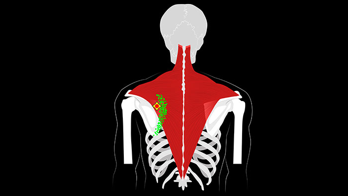 trapezius trigger points